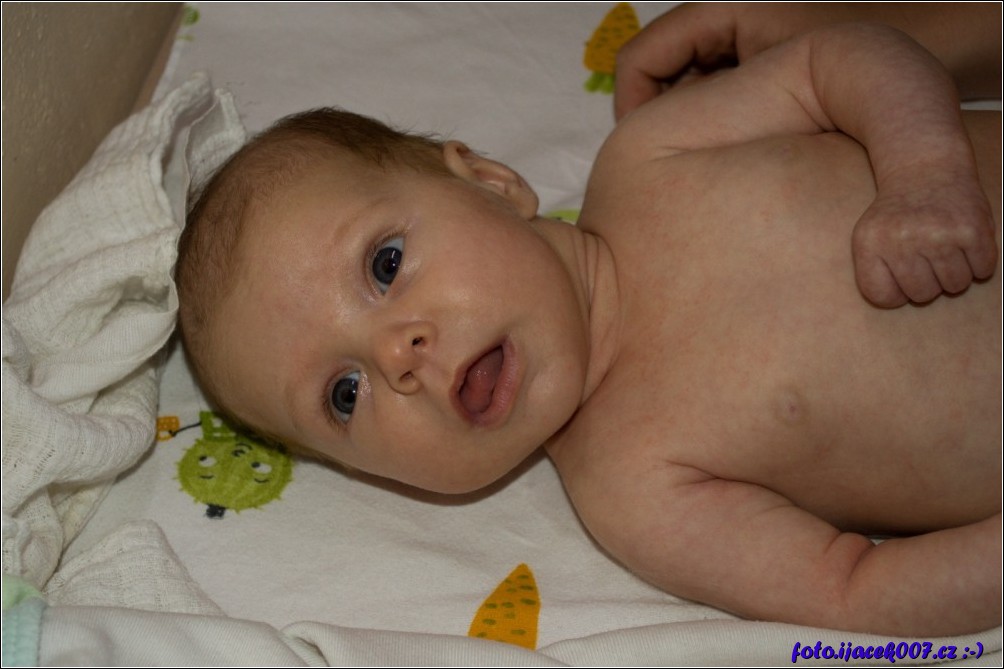 Klikněte pro zobrazení původního obrázku